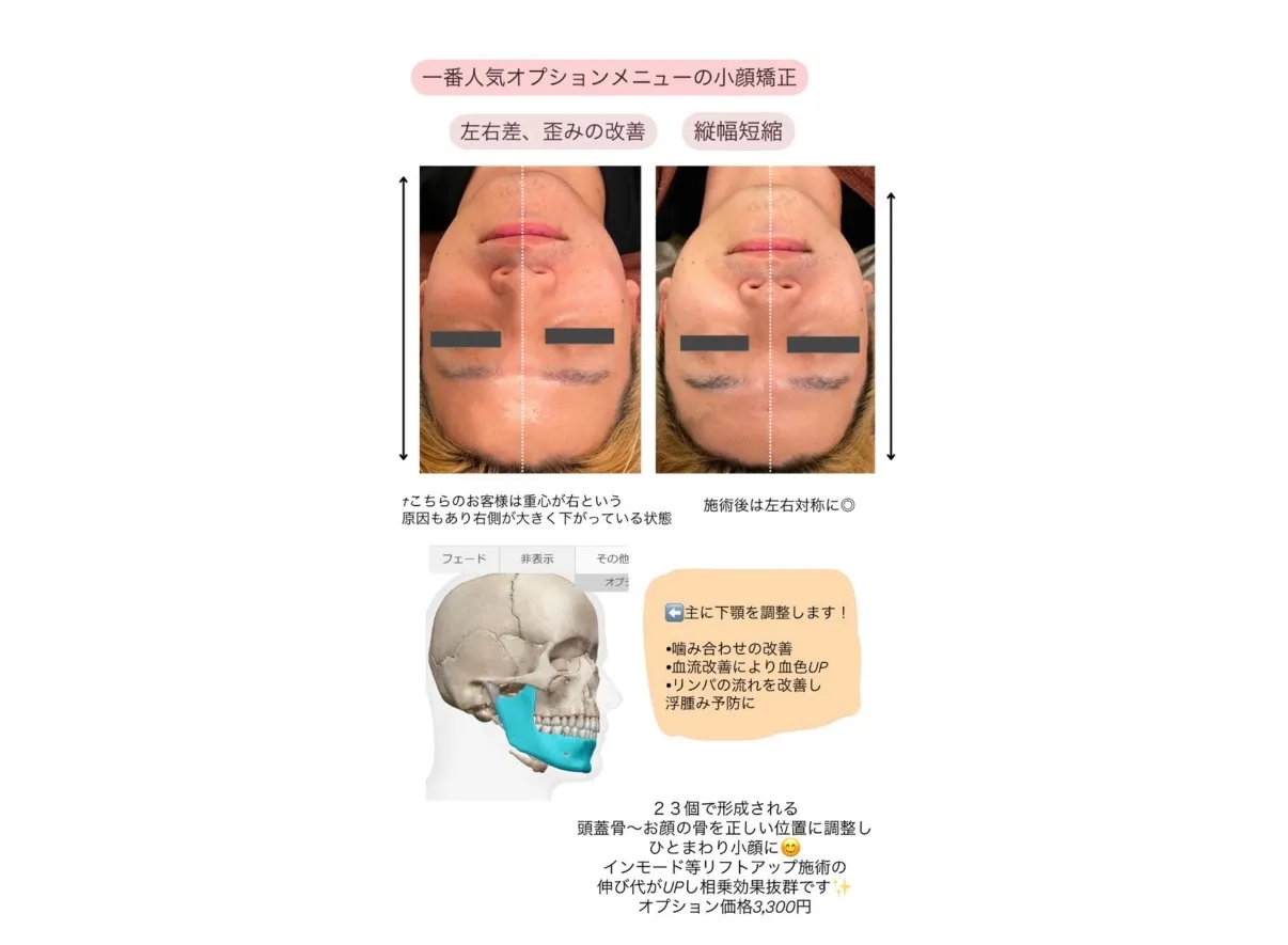 【柏市】前半◎左右差・歪み改善💗小顔矯正で浮腫みや老化予防💆♀️✨